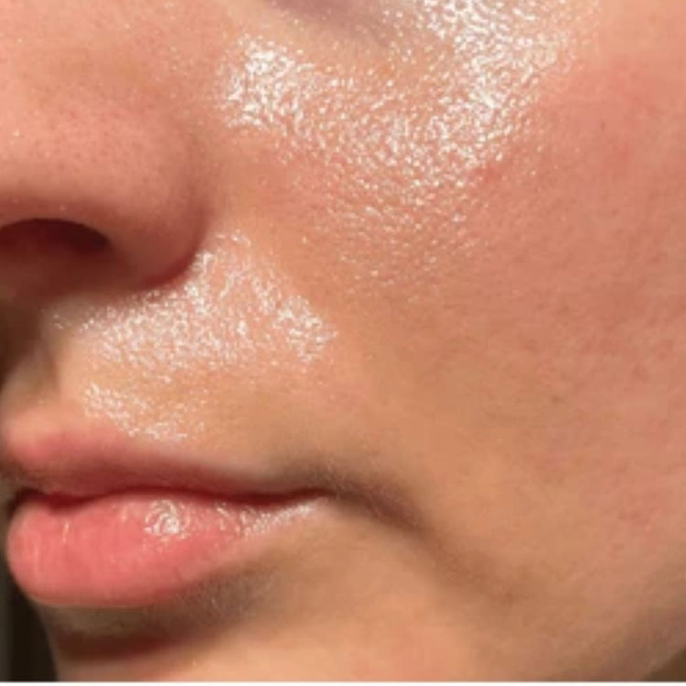 Oily Skin Care